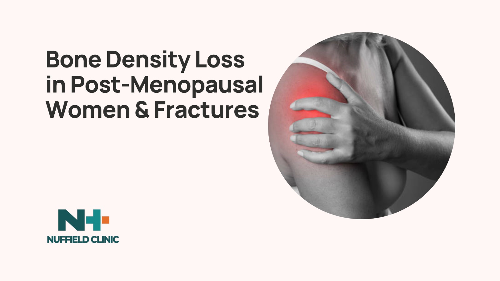 How to Manage Bone Density Loss in Post-Menopausal Women and Prevent Fractures