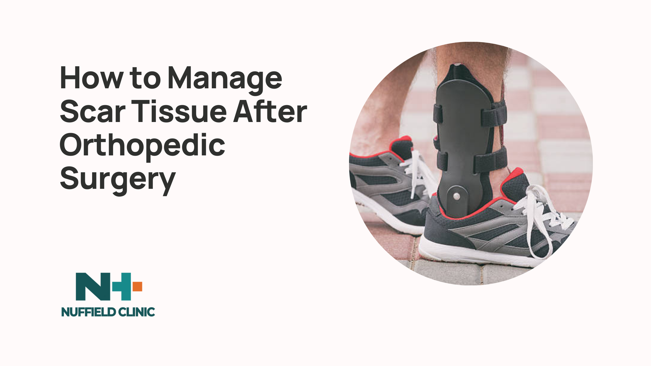 How to Manage Scar Tissue After Orthopedic Surgery