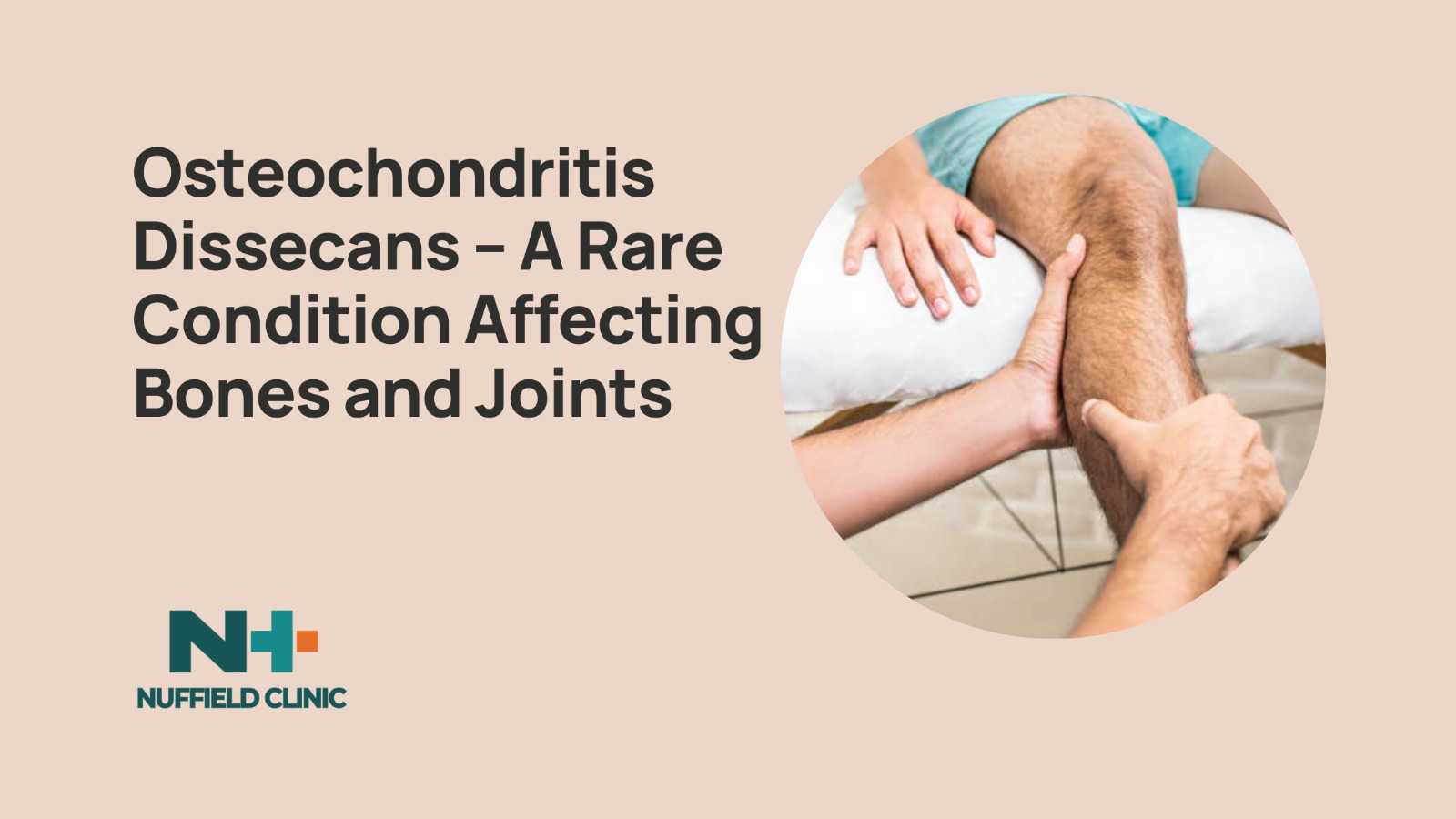 Osteochondritis Dissecans – A Rare Condition Affecting Bones and Joints