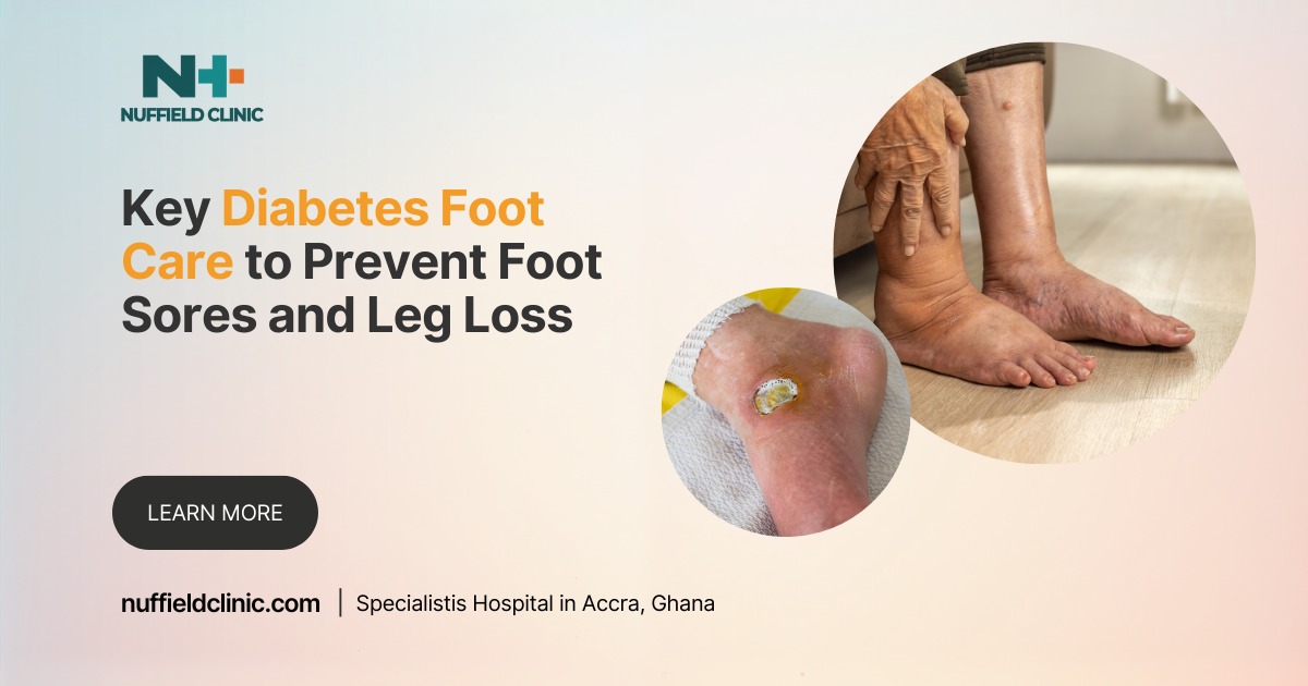 Key Diabetes Foot Care to Prevent Foot Sores and Leg Loss
